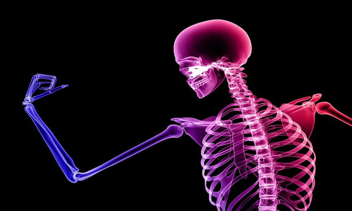 5 Penyakit Tulang yang Jarang Disadari Segera Cek Sebelum ...