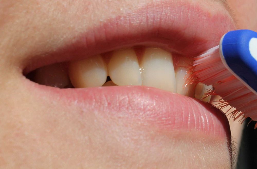 Penyebab Gigi Berlubang yang Perlu Diwaspadai